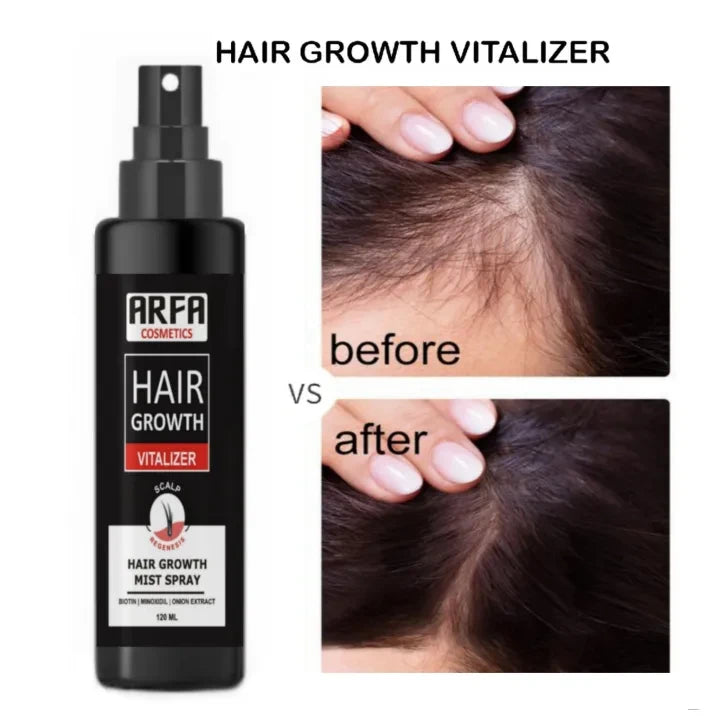 FORT Minoxidil Hair Growth Spray