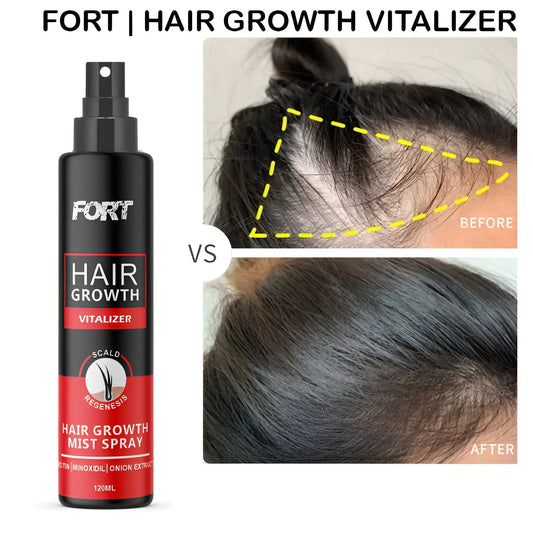 FORT Minoxidil Hair Growth Spray