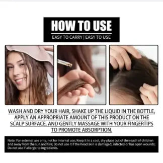 FORT Minoxidil Hair Growth Spray