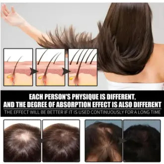 FORT Minoxidil Hair Growth Spray